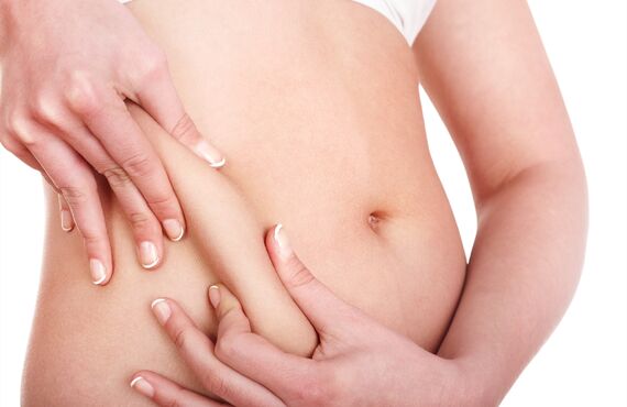 高松でセルライトをケアするダイエットについて指導しているサロンです